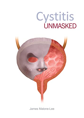 Beispielbild fr Cystitis Unmasked zum Verkauf von WorldofBooks