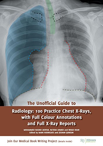 Stock image for The Unofficial Guide to Radiology: 100 Practice Chest X Rays with Full Colour Annotations and Full X Ray Reports (Unofficial Guides) for sale by Front Cover Books