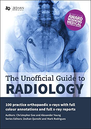 Stock image for The Unofficial Guide to Radiology: 100 Practice Orthopaedic X Rays With Full Colour Annotations and Full X Ray Reports for sale by Revaluation Books