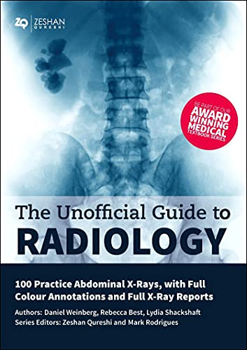 9781910399033: The Unofficial Guide to Radiology: 100 Practice Abdominal X Rays with Full Colour Annotations and Full X Ray Reports (Unofficial Guides to Medicine)