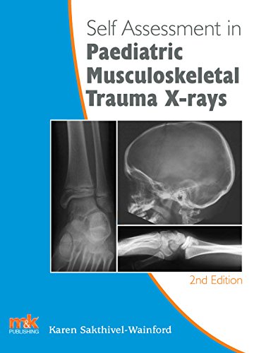 Stock image for Self-Assessment in Paediatric Musculoskeletal Trauma X-Rays (Self-Assessment in X-rays) for sale by Revaluation Books