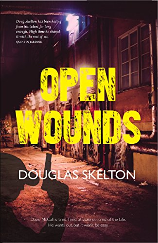 Stock image for Open Wounds (Davie McCall Series): 4 for sale by WorldofBooks