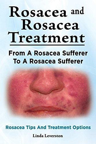 Stock image for Rosacea and Rosacea Treatment. from a Rosacea Sufferer to a Rosacea Sufferer. Rosacea Tips and Treatment Options (Paperback or Softback) for sale by BargainBookStores