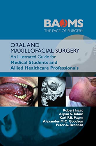 Stock image for Oral and Maxillofacial Surgery: An Illustrated Guide for Medical Students and Allied Healthcare Professionals for sale by GF Books, Inc.