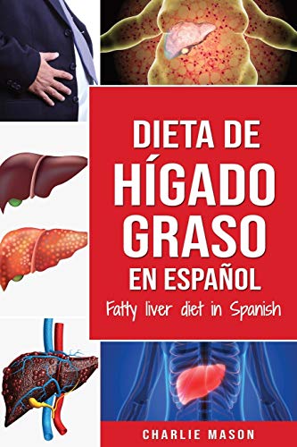 9781913540845: Dieta de hgado graso en espaol/Fatty liver diet in Spanish