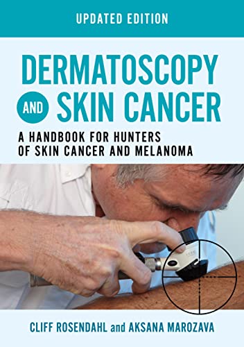 Stock image for Dermatoscopy and Skin Cancer, updated edition: A handbook for hunters of skin cancer and melanoma for sale by BooksRun