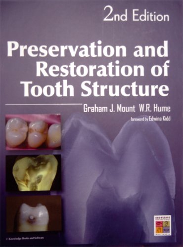 Beispielbild fr Preservation and Restoration of Tooth Structure zum Verkauf von WorldofBooks