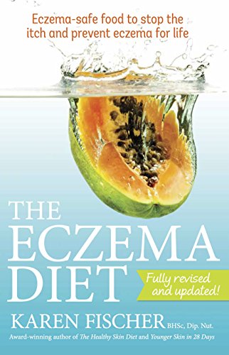 Beispielbild fr Eczema Diet: Eczema-safe food to stop the itch and prevent eczema for life zum Verkauf von BooksRun