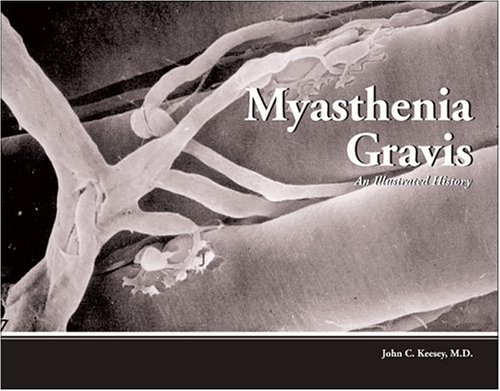 Stock image for Myasthenia Gravis: An Illustrated History for sale by More Than Words