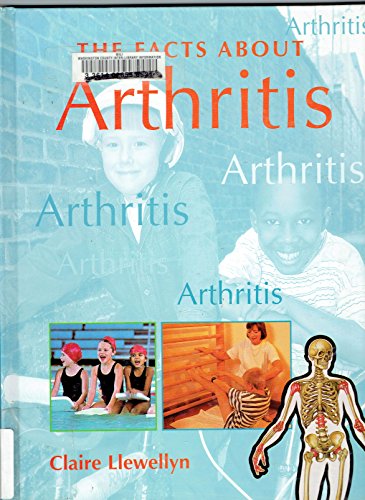 Beispielbild fr Arthritis zum Verkauf von Better World Books: West