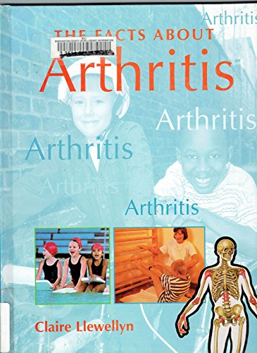 9781929298990: The Facts About Arthritis