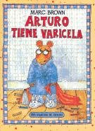 Imagen de archivo de Arturo tiene varicela/ Arthur's Chicken Pox (Una aventura de Arturo / An Arthur Adventure) (Spanish Edition) a la venta por Half Price Books Inc.