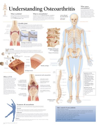 9781930633148: Osteoarthritis, Paper Chart