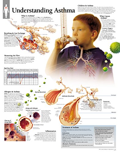 Understanding Asthma chart: Wall Chart (9781930633162) by [???]