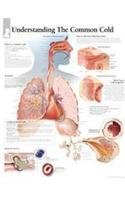 The Common Cold chart: Laminated Wall Chart (9781930633438) by [???]