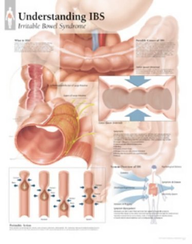 9781930633506: Understanding IBS Paper Poster