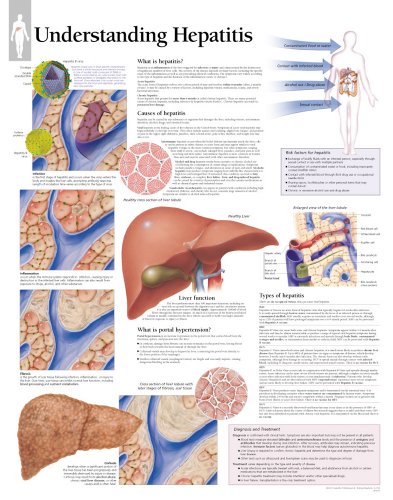 Understanding Hepatitis chart: Wall Chart (9781930633841) by [???]