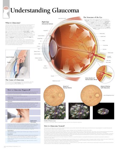 Understanding Glaucoma chart: Laminated Wall Chart (9781930633872) by [???]