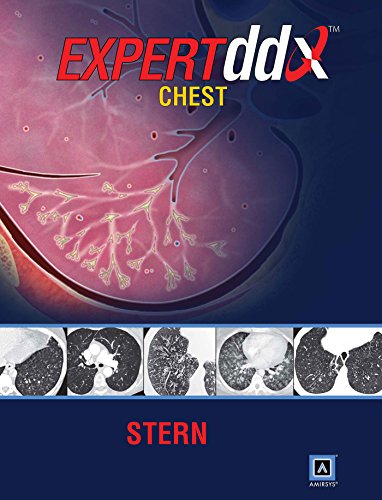 Imagen de archivo de Expertddx: Chest (EXPERTddx (TM)) a la venta por The Book Spot