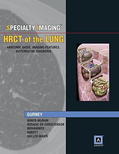 Imagen de archivo de Specialty Imaging: HRCT of the Lung, Anatomic Basis, Imaging Features, Differential Diagnosis a la venta por Wonder Book