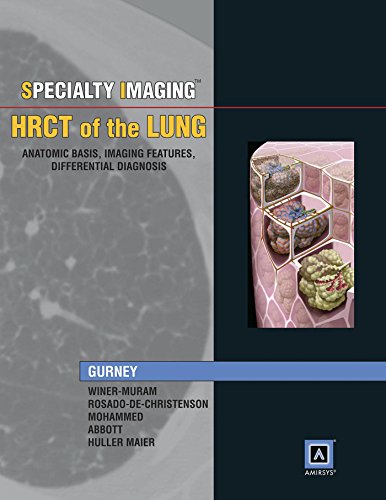 Stock image for Specialty Imaging: HRCT of the Lung, Anatomic Basis, Imaging Features, Differential Diagnosis for sale by Wonder Book