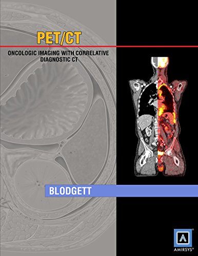 9781931884181: Specialty Imaging: PET/CT: Oncologic Imaging with Correlative Diagnostic CT (Published by Amirsys)