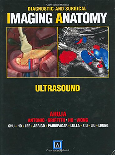 Beispielbild fr Diagnostic and Surgical Imaging Anatomy: Ultrasound zum Verkauf von ZBK Books