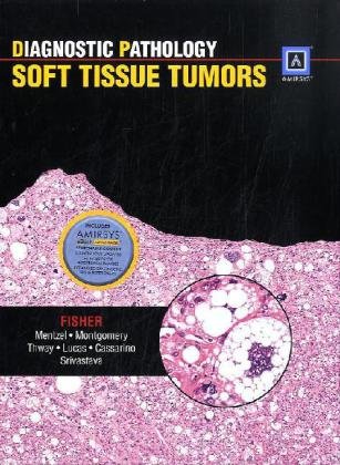 Beispielbild fr Soft Tissue Tumors zum Verkauf von Better World Books
