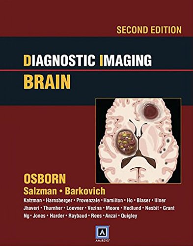 Beispielbild fr Diagnostic Imaging: Brain zum Verkauf von HPB-Red