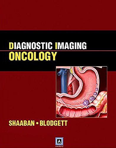 Beispielbild fr Diagnostic Imaging Oncology zum Verkauf von BooksRun