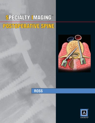 Stock image for Specialty Imaging: Postoperative Spine for sale by Salish Sea Books