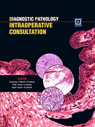 Beispielbild fr Diagnostic Pathology: Intraoperative Consultation zum Verkauf von Studibuch