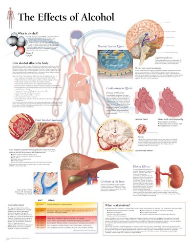 The Effects of Alcohol chart: Laminated Wall Chart (9781932922028) by [???]