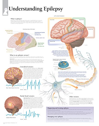 Understanding Epilepsy chart: Laminated Wall Chart (9781932922226) by [???]