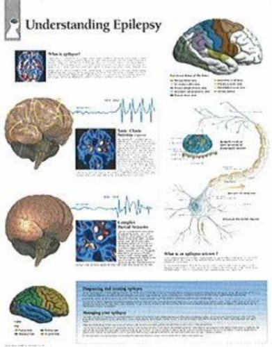Understanding Epilepsy chart: Wall Chart (9781932922233) by [???]