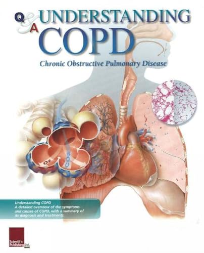 Understanding COPD Flip Chart (9781932922295) by [???]