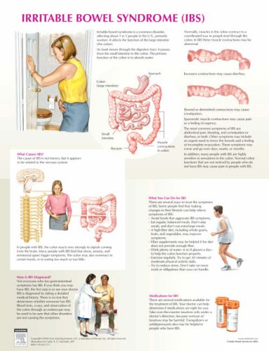 Irritable Bowel Syndrome Chart (Netter Charts) (9781933247175) by Netter MD, Frank H.