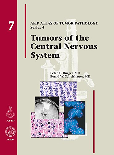 Stock image for Tumors of the Central Nervous System (Afip Atlas of Tumor Pathology) for sale by HPB-Red