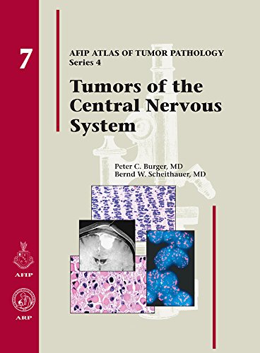9781933477015: Tumors of the Central Nervous System (Afip Atlas of Tumor Pathology)