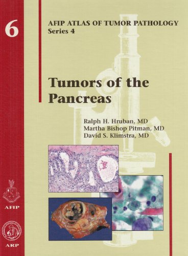 9781933477022: Tumors of the Pancreas (AFIP Atlas of Tumor Pathology, Series 4,)