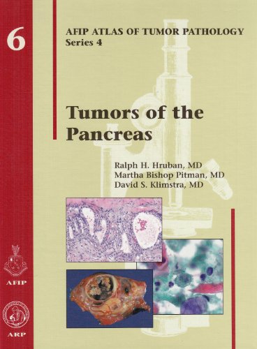 Stock image for Tumors of the Pancreas (Afip Atlas of Tumor Pathology; 4th Series Fascicle 6) for sale by Books of the Smoky Mountains