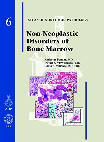 Beispielbild fr Non-Neoplastic Disorders of Bone Marrow (Atlas of Nontumor Pathology) zum Verkauf von SecondSale