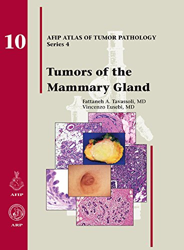 Imagen de archivo de Tumors of the Mammary Gland (AFIP Atlas of Tumor Pathology: Series 4) a la venta por SecondSale