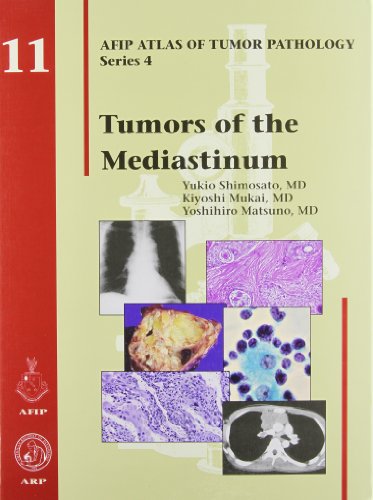 Beispielbild fr TUMORS OF THE MEDIASTINUM (Atlas of Tumor Pathology) zum Verkauf von Wonder Book