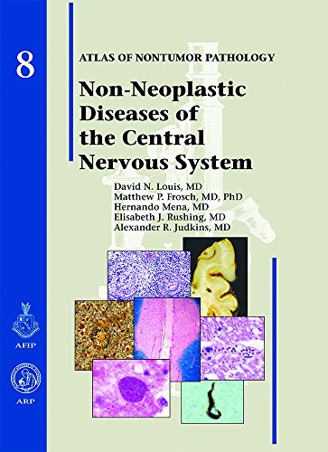Imagen de archivo de Non-neoplastic Diseases of the Central Nervous System: Vol 8 a la venta por Revaluation Books