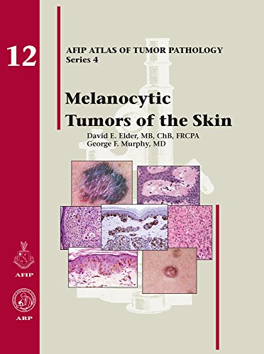 9781933477107: Melanocytic Tumors of the Skin (AFIP Atlas of Tumor Pathology, Series 4,)