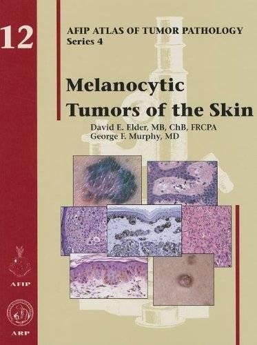 9781933477107: Melanocytic Tumors of the Skin