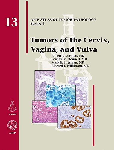 9781933477114: Tumors of the Cervix, Vagina, and Vulva: 13 (AFIP Atlas of Tumor Pathology, Series 4,)