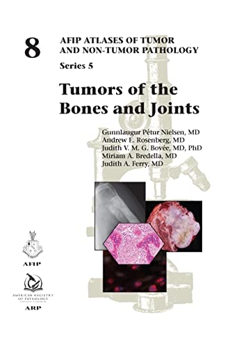 Imagen de archivo de Tumors Of The Bones And Joints a la venta por Revaluation Books