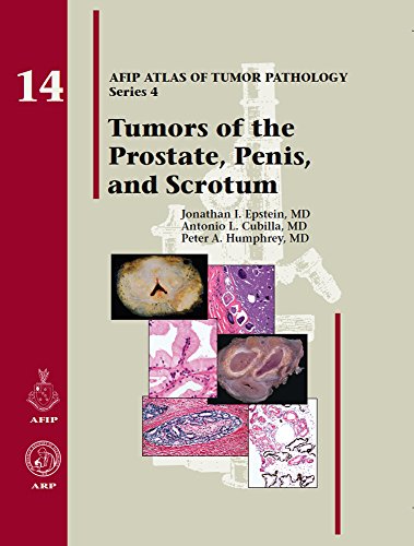 Imagen de archivo de Tumors of the Prostate Gland, Seminal Vesicles, Penis, and Scrotum: 14 (AFIP Atlas of Tumor Pathology: Series 4) a la venta por KuleliBooks